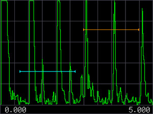 Display 5, San Mode, Largest A-Scan Area